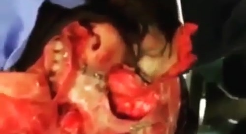 Inside of a Face - in Case you Wondered