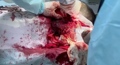 Video from a military hospital. /4.