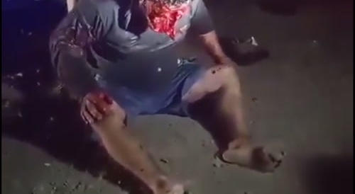 Faceless after Crash