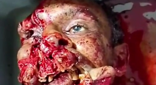 Video Right From The Morgue