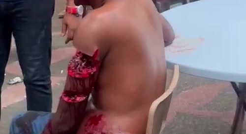 Dude left with some chop wounds