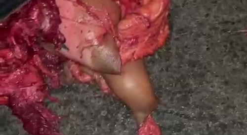 Woman turned into a meat pile
