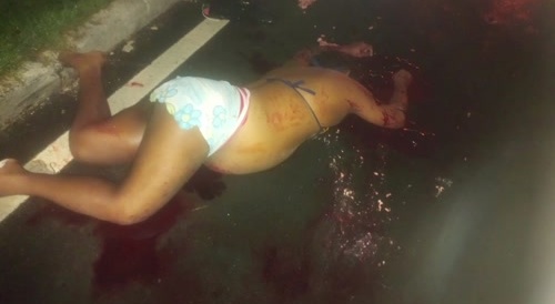 Trans woman hit by car