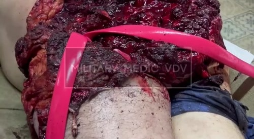 Video from a military hospital. /6.