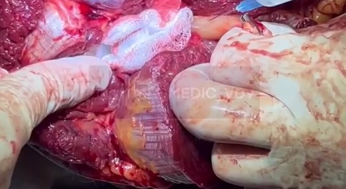 Video from a military hospital. /2.