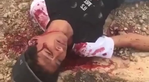 Got killed because some ice