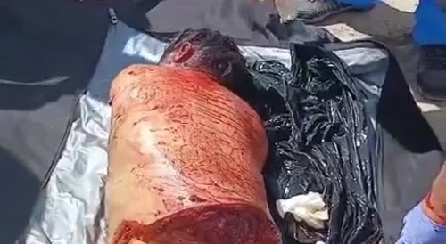Dismembered woman