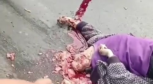 Crushed head.