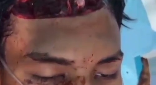 Smiling Head