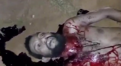 Mother Fucker Leaks After Being Stabbed By A Bottle