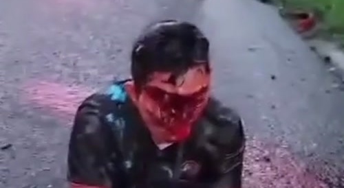 dude face got fucked up