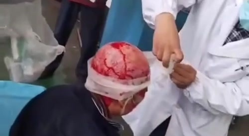 Woman got scalped at factory