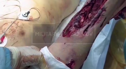 Video from a military hospital. /5