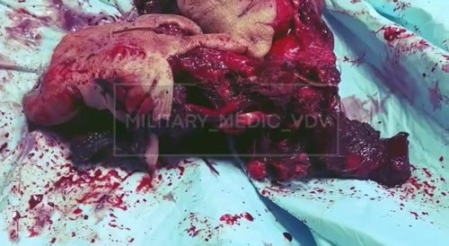 Video from a military hospital. /6.