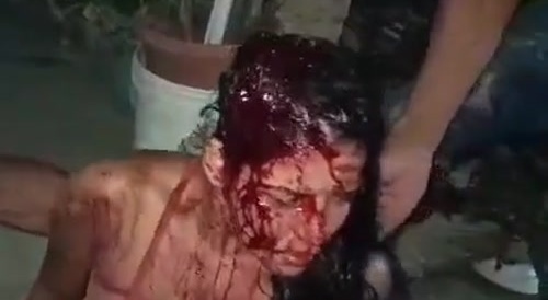 left her bloodied