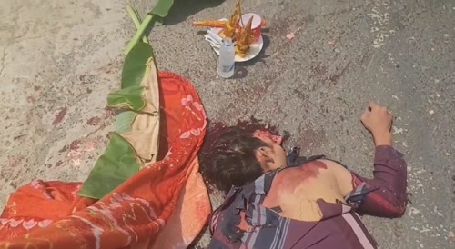 Mutilated after accident