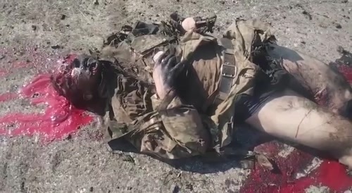 Victim of an explosion.