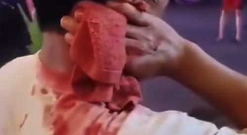 Just a minor scratch