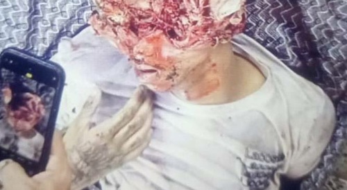 Drug dealer "TH" and his guard "Gotinha" killed