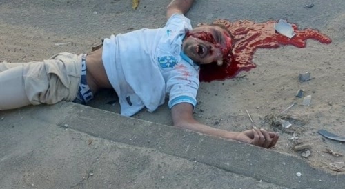 Biker Busted his head on the wall
