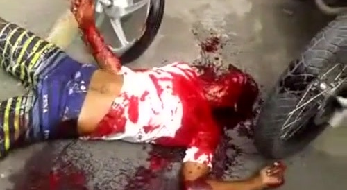 Guy Choke On His Own Blood After Getting Shot