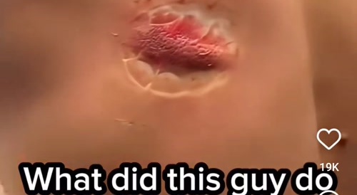 HorseBite
