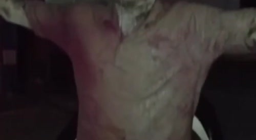 Man got burnt at work