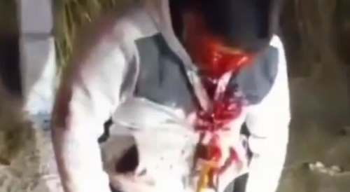 How did he survive THAT??(cartel)