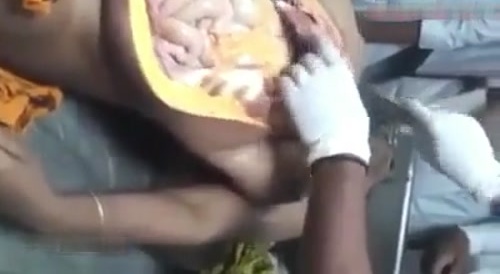 Autopsy.