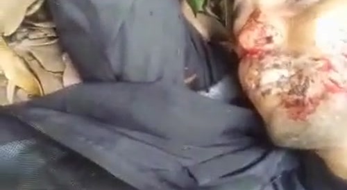 Stabbing His Face Multiple Times & Poking Out His Eye With Knife