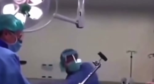 removal of a tibial nail