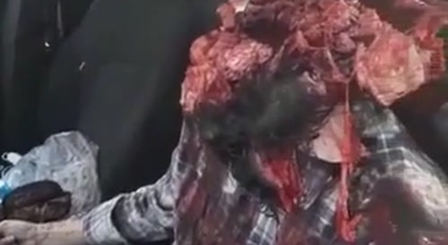 Dude Blew Brains Out With Shotgun