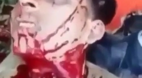 Cartel Pops Gay Guy's Head Off Like A Bottle Cap.