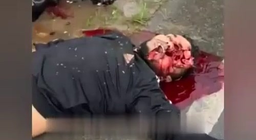 Bike Accident left dude smile