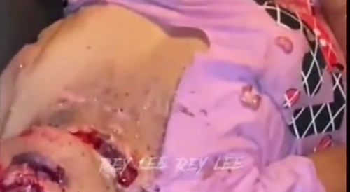 Horrific Double-Female Crash