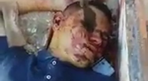 Ending up dead in dumpster with butcher knife in his eye... !