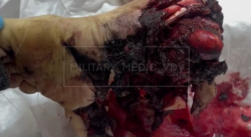 Video from a war hospital.