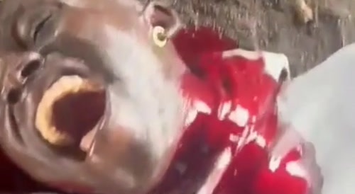 Man Chokes On His Own Blood In Haiti.