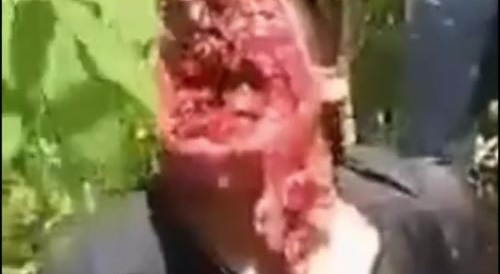 Dude survives a shotgun to the face