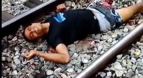 Dude Lost His Leg On The Tracks