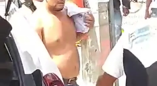 Sliced By Machete
