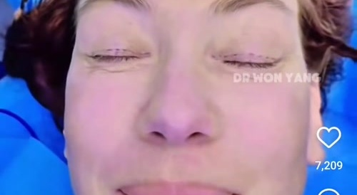 Russian Facelift