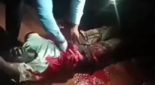 Video of South Sudanese Man having his intestines Shoved Back Into His stomach. Too Gruesome