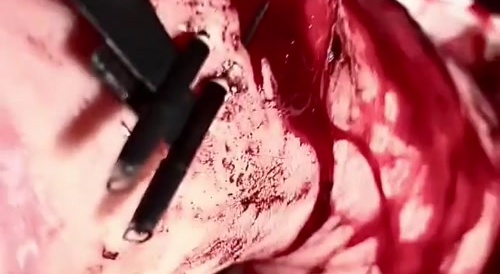 Self-mutilation : there is no god... !