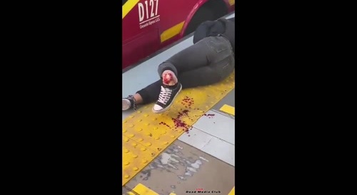 A woman having stood too close... !