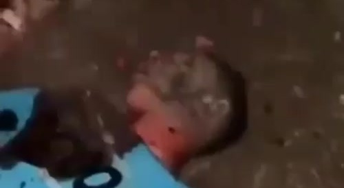 Shots to the head...