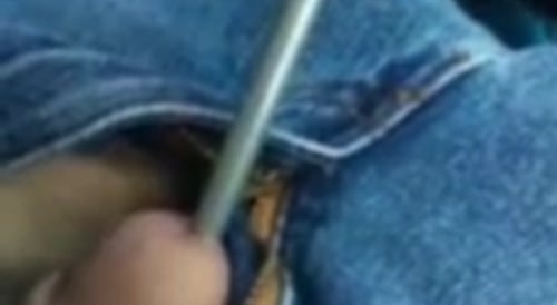 A man pulls out a screwdriver from his penis... !