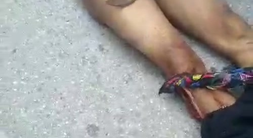 Bunch of Africans sliced off the victim's head, forearms & penis... !