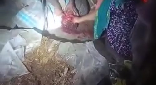Siblings gouge out brother's eyes 'on father's order'... !