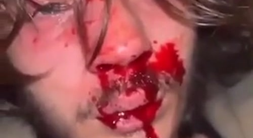 the result of shit talking online
